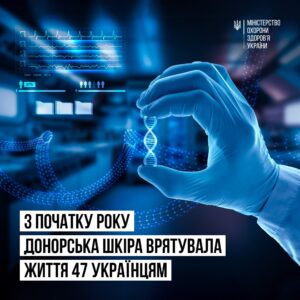З початку року донорська шкіра врятувала життя 47 пацієнтам