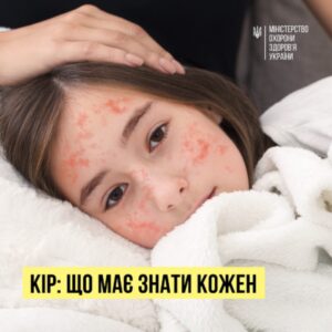 Кір: що має знати кожен