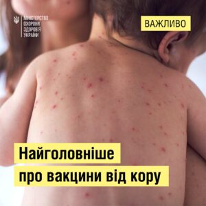 Щеплення проти кору